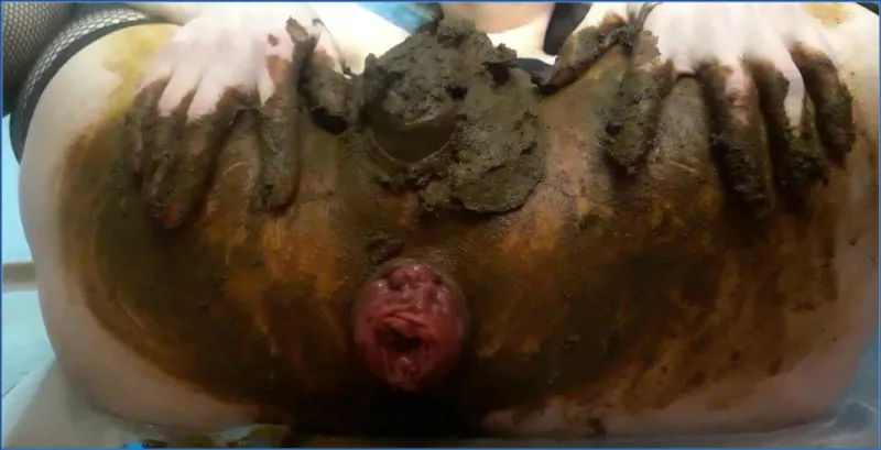 Scatlina toont anale prolaps midden in haar eigen scat - scat video op OranjeScat